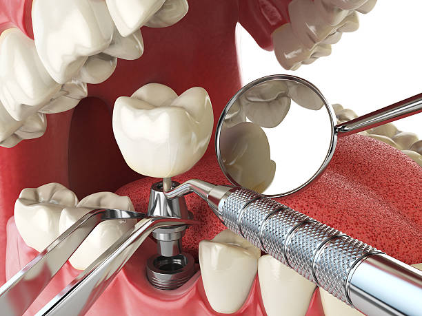 Best Emergency Wisdom Teeth Removal in Whitley City, KY